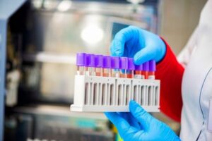 В Беларуси установлены предельно допустимые цены на коронавирусные тесты