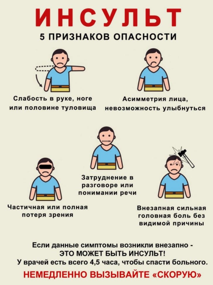 "Инсульты встречаются даже у детей". Почему важна каждая минута при появлении симптомов